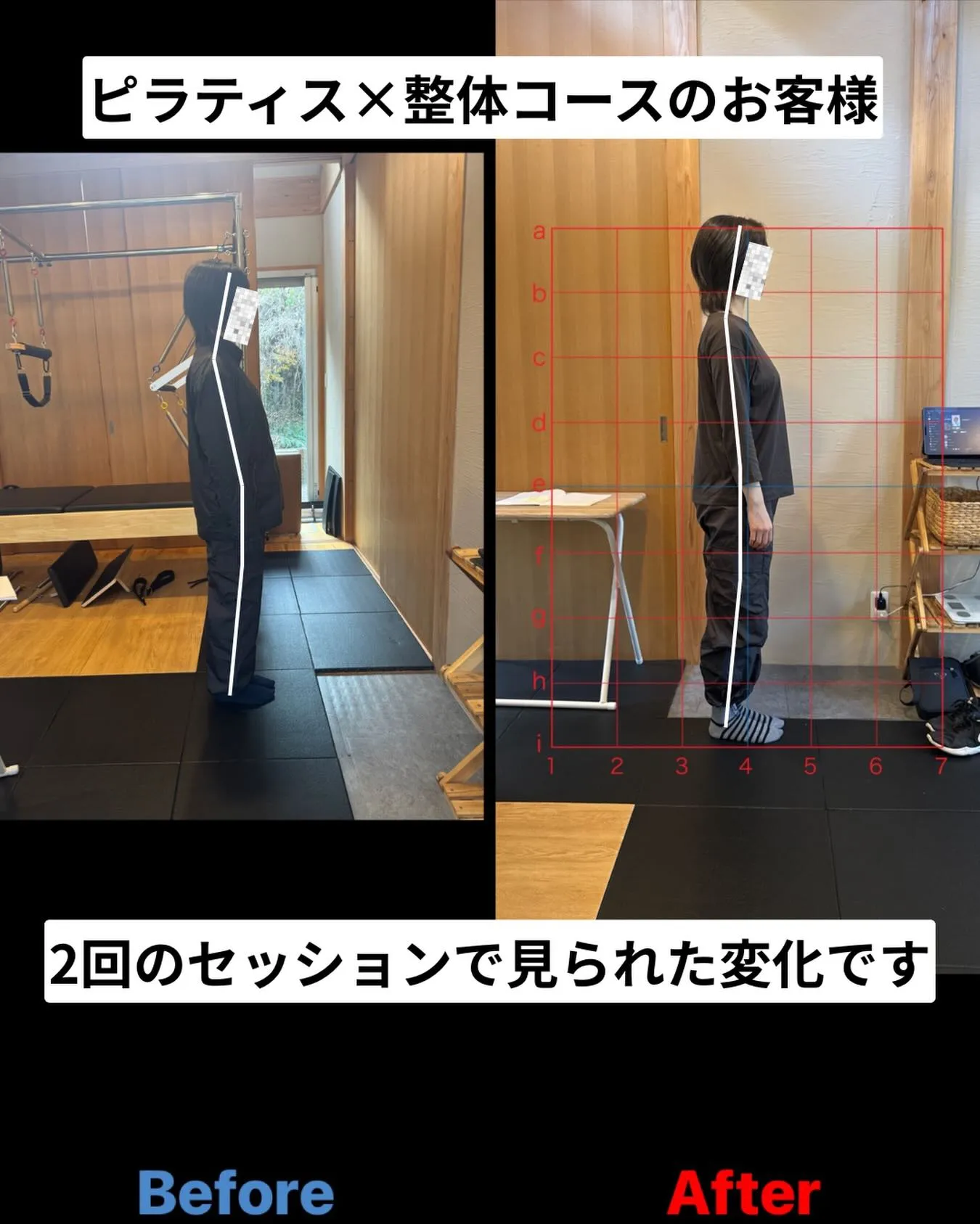 ピラティス×整体コースご利用のお客様のbefore.afte...